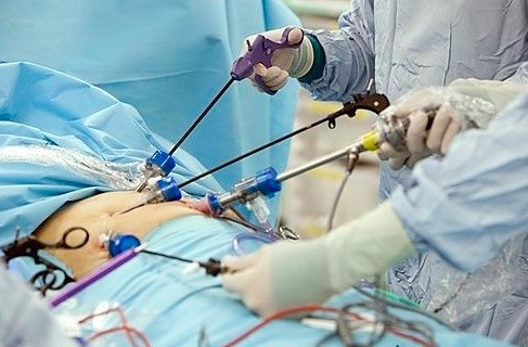 Rak nerki - operacja